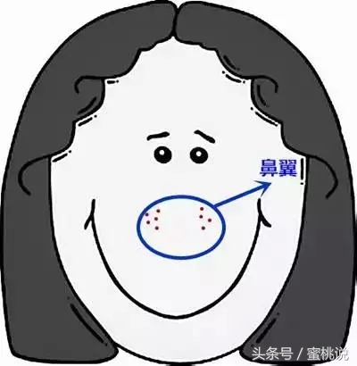 12岁脸上长痘按什么穴位,各个部位长痘原因太阳穴