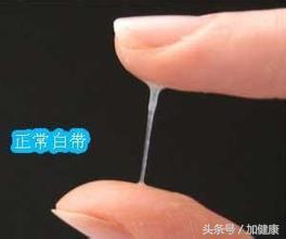 关于女性的健康白带小常识,食疗妙治白带异常