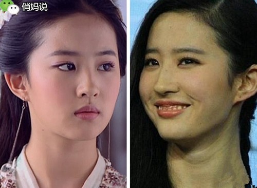 宝宝笑起来露牙龈是什么原因,6岁孩子露牙龈笑最简单改善方法