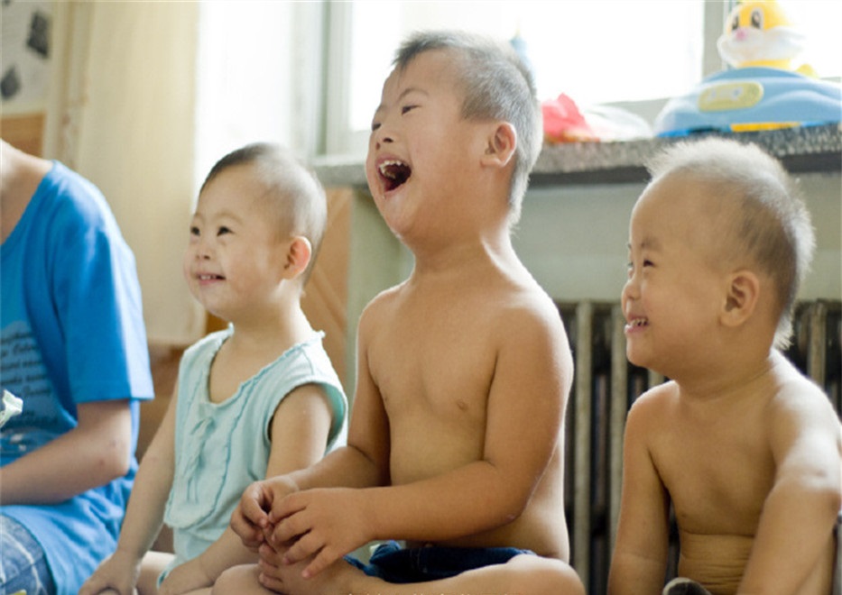患有唐氏综合征的宝宝,唐氏综合征宝宝越吃越瘦
