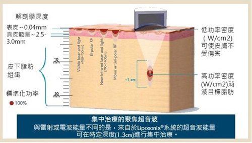 超声刀讲解视频,超声刀的资料与知识