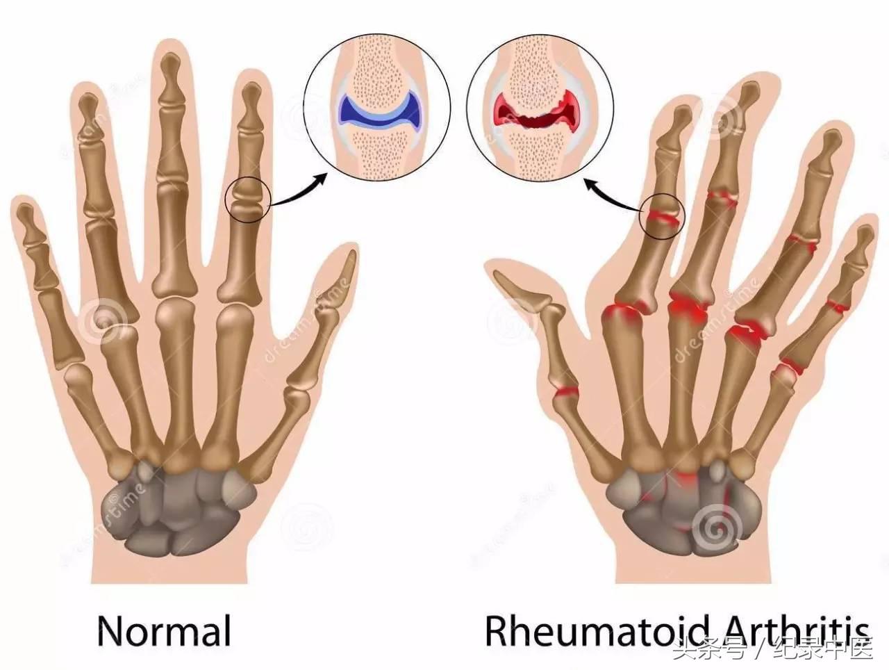 记录癌症被治好的一本书,被判无期的中医