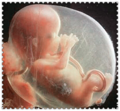 产妇生死未卜丈夫哭了,产妇生命垂危