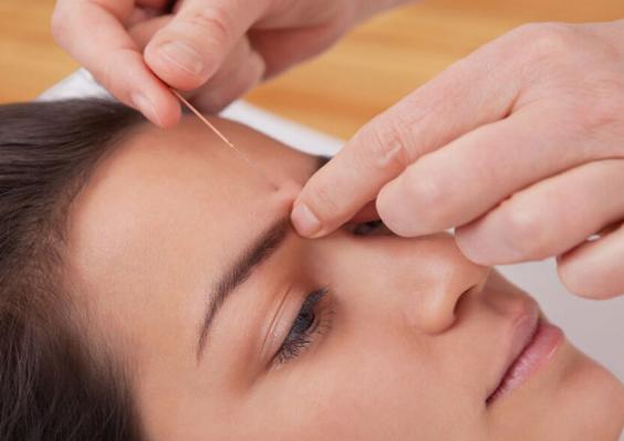 痘痘看医生怎么治疗,针对痘痘所做的医学治疗