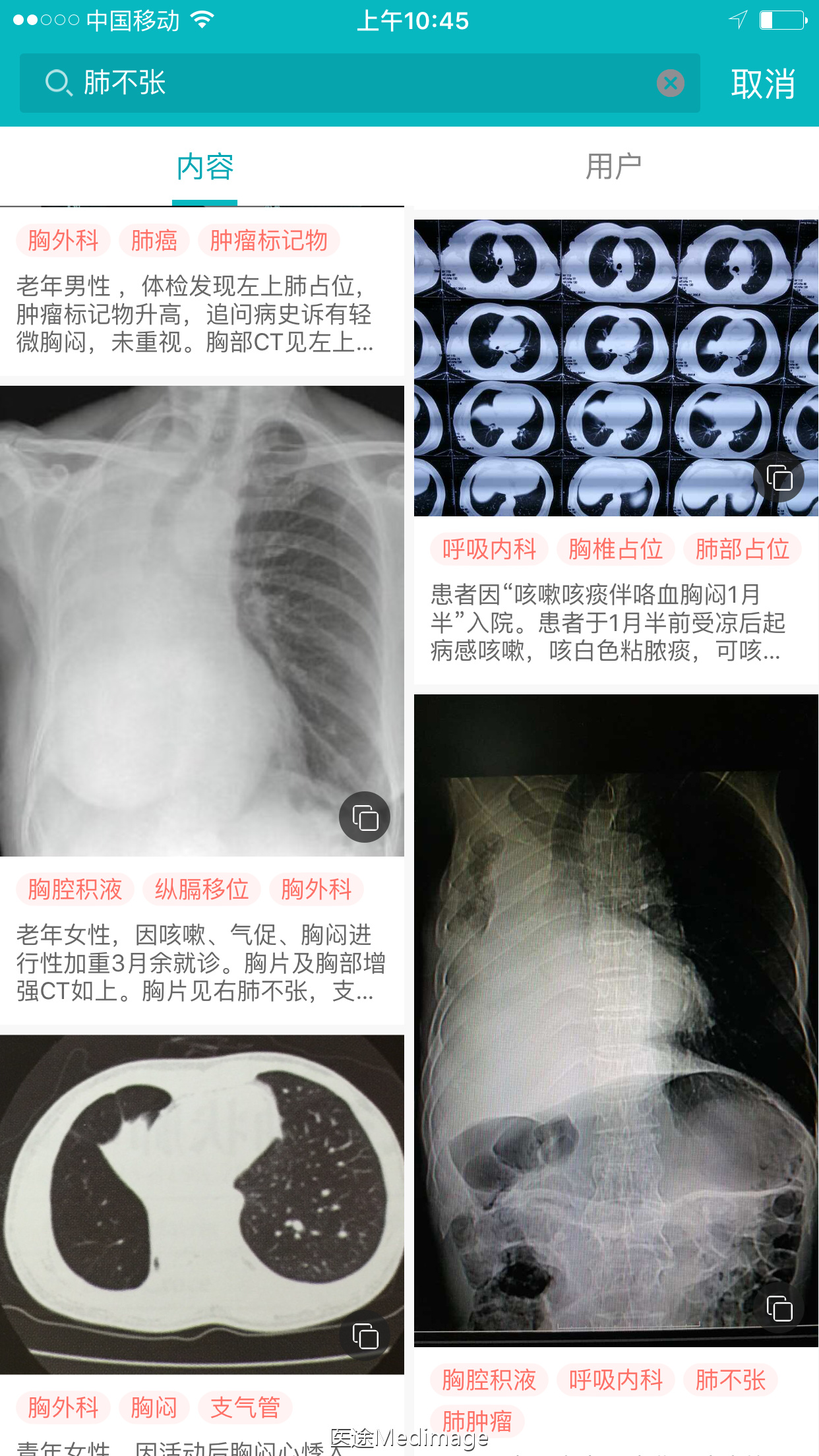 胸部ct扫描双肺未见明显异常,胸部ct报告心脏不大正常吗