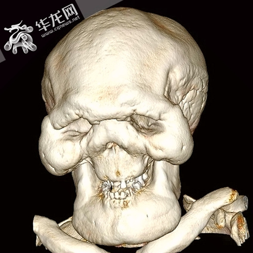 男子被怪病困扰十年,男子被怪病困扰20年