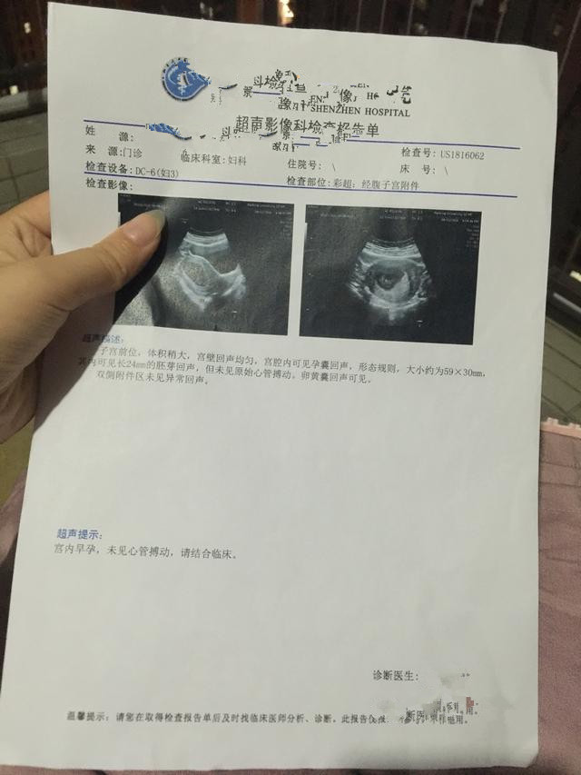 怀孕10周，检查说胚胎停育，要崩溃了！
