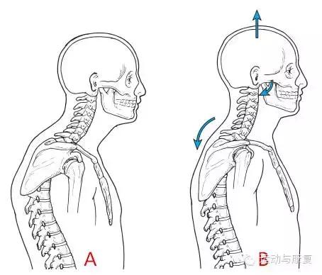 颈椎侧弯高低肩驼背,颈椎凸怎么练