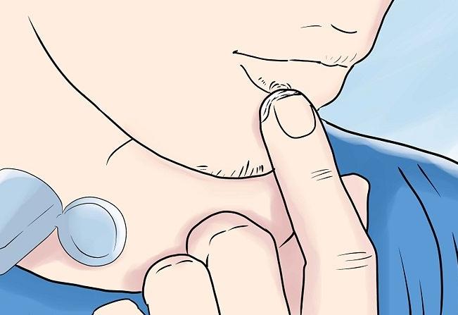 一点都不“单纯”的单纯性疱疹,中医却能轻松搞定!