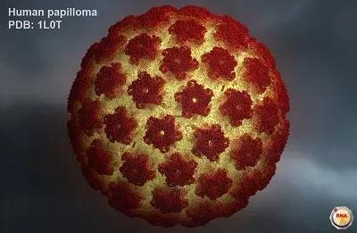 尖锐性湿疣会造成癌症吗,尖锐性湿疣会导致哪种癌症