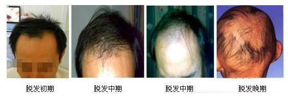 生姜洗发水去屑止痒控油防脱生发,生姜洗发水哪个牌子生发效果好