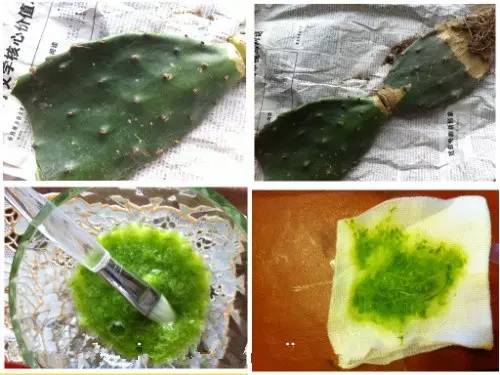 家长得了腮腺炎小孩如何预防,小孩流行性腮腺炎怎么预防