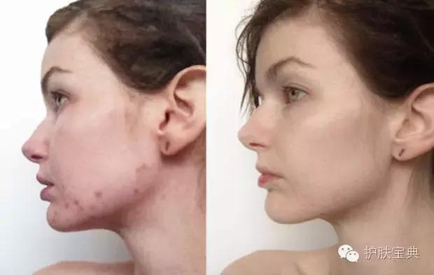 世界洁面仪排名,好用的七款洁面仪排行榜