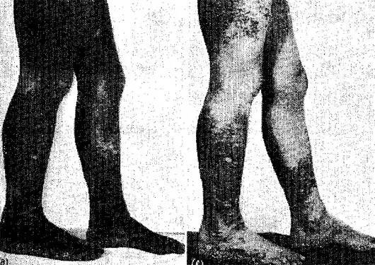 奇幻催眠术整套,一个神奇的催眠术