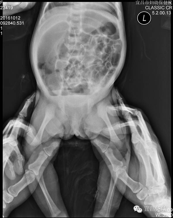 孩子腹胀属于什么科室,腹胀腹痛五十天了该做什么检查