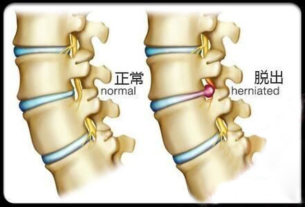 腰疼是有重大疾病吗,腰疼除了腰的问题还有别的原因