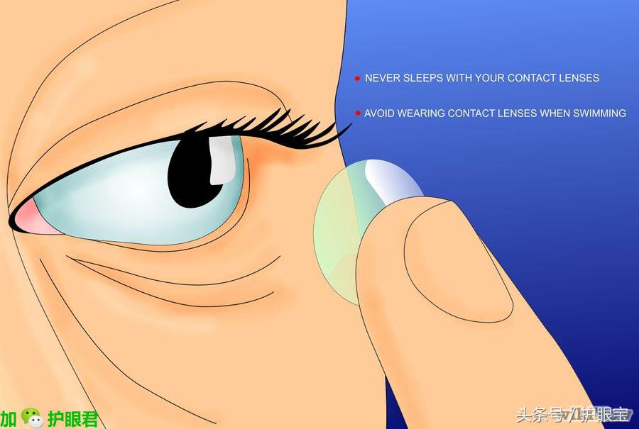 护眼小知识怎样延缓近视加深呢,眼科医生如何护眼