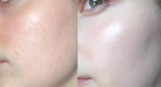 干皮秋冬最好用的24小时粉底液,怎么选择一款适合混干皮的粉底液