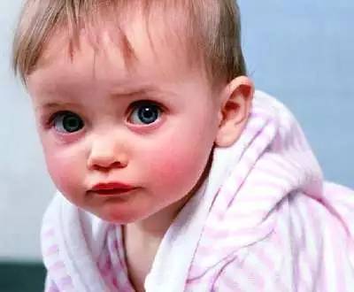 冬天脸红发热是什么原因造成的,宝宝冬天脸红擦什么面霜比较好