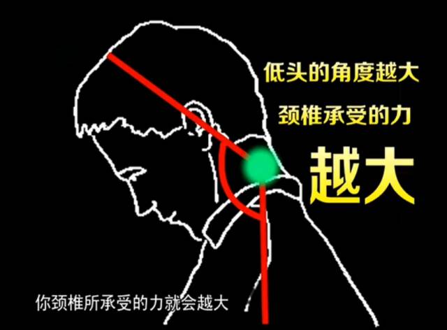 仰泳与蛙泳哪个对颈椎更好,蛙泳会不会加重颈椎反弓