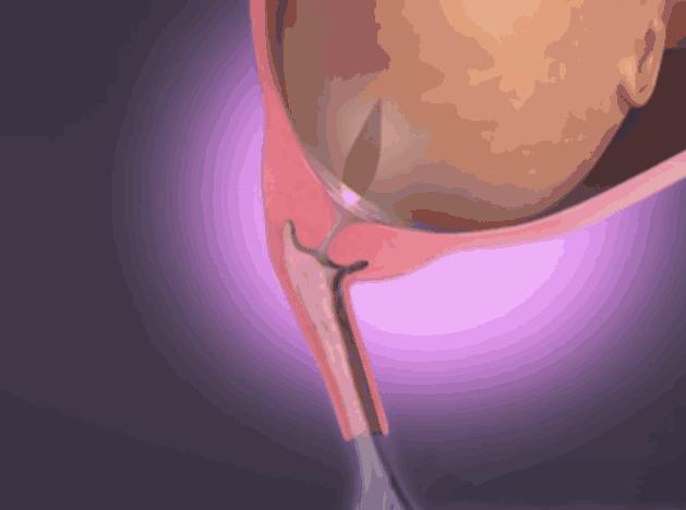 生孩子之前做什么动画演示,动画演示生孩子的各个阶段