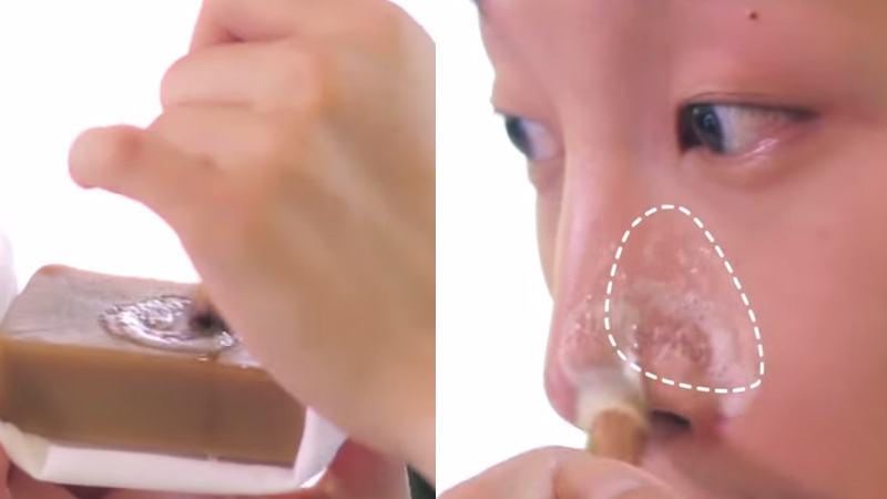 男生去美容院祛黑头有用吗,男生黑头去除正确方法