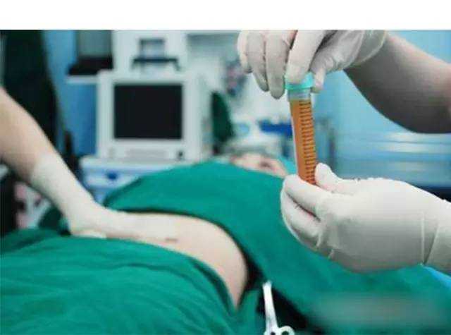 瘦身最快的方法还不长肌肉,减肥瘦身最有效的办法