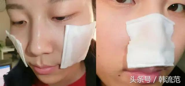 城野医生毛孔收敛水效果怎么样,城野医生毛孔收敛水可以祛闭口吗