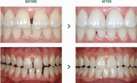 一白遮三丑皮肤白,一白遮三丑一口龅牙毁所有