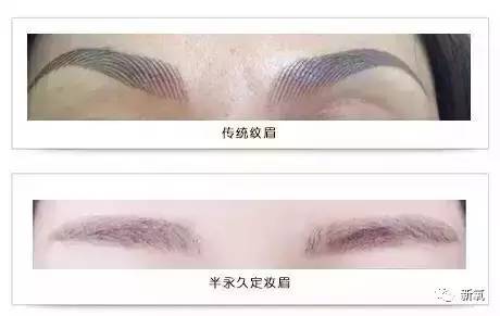 瞒着家人做了美瞳线,做美瞳线为什么会引起角膜炎