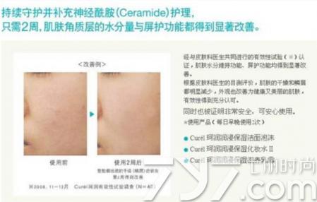 珂润面霜如何辨别真假图片对比,珂润面霜真假鉴别方法图片对比