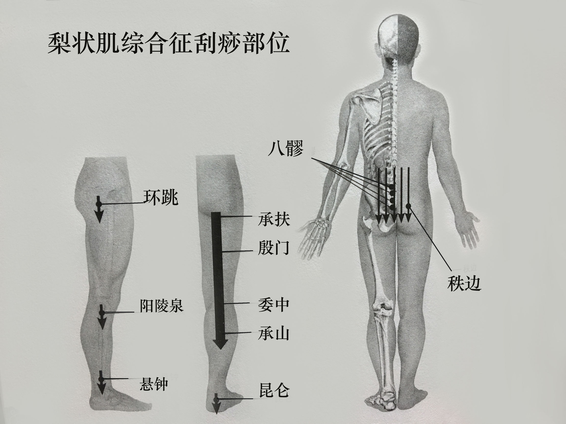 梨状脊肌综合征怎么治了,退行性脊柱炎最佳治疗方案