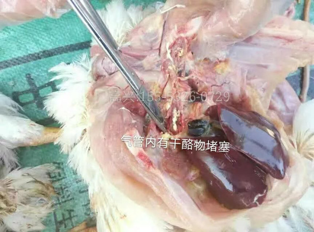 支气管堵塞怎么治疗最好,支气管堵塞最好的解决方法