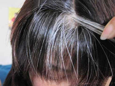 年纪轻轻就有白头发，简单4步可得到大大缓解