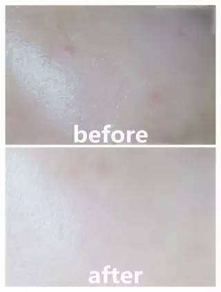 为什么你下重金护肤，却还是比不上她？