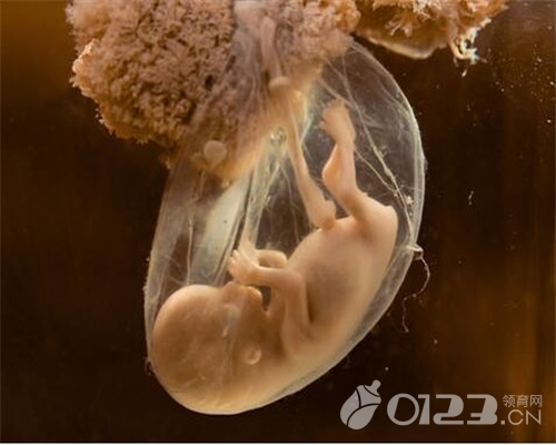 孕妇羊水不足的原因,孕妇羊水不足怎么办