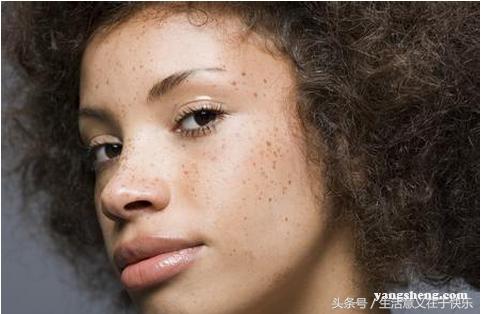 皮肤癌患者早期都有哪些症状,皮肤癌有哪些症状和表现