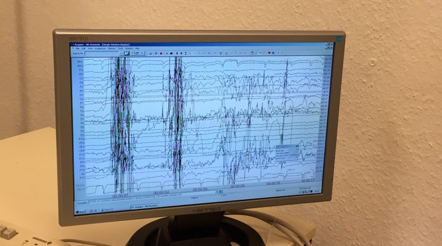 做核磁共振半道跑出来的多吗,做核磁共振途中为什么要推针水