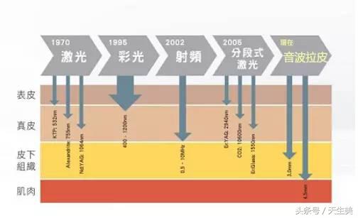 超声刀怎么样啊 (超声刀分享)