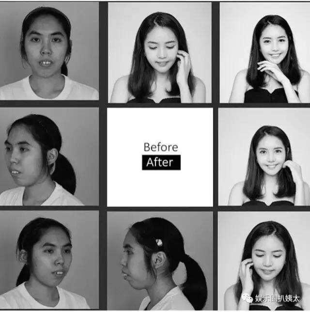 泰国专门的整容节目,泰国的整容节目有哪些