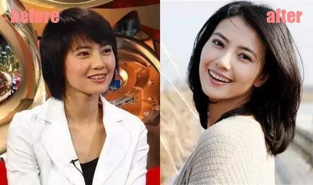 整牙=整容？看杨幂、刘涛、高圆圆为你亲身示范！