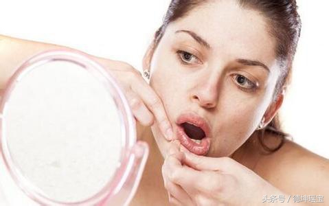 女子挤痘导致脸肿了,一女子挤痘痘脸部肿大