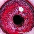 鸽子眼怎么区分明和暗,鸽子眼基本结构讲解