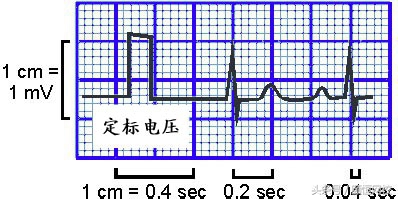 郭雅卿零基础心电图教学口诀,郭老师教你心电图口诀