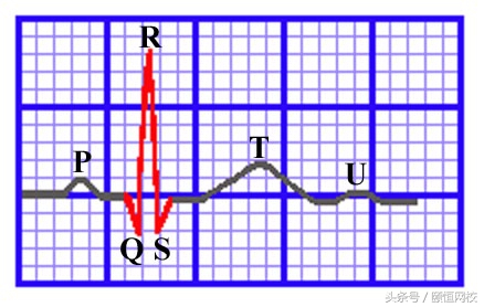 郭雅卿零基础心电图教学口诀,郭老师教你心电图口诀
