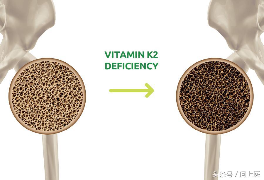 抱子甘蓝迷你小包菜3月能种吗,抱子甘蓝跟包菜口感一样吗