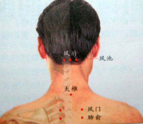 风寒感冒针刺放血注意事项,通过放血治疗疾病方法可取吗