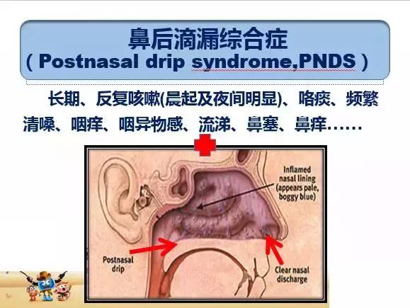 咳嗽咳痰反复发烧,宝宝反复咳嗽咳痰