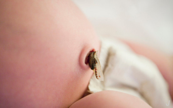 新生儿脐带还没掉怎么护理,新生儿脐带还没有完全脱落怎么办