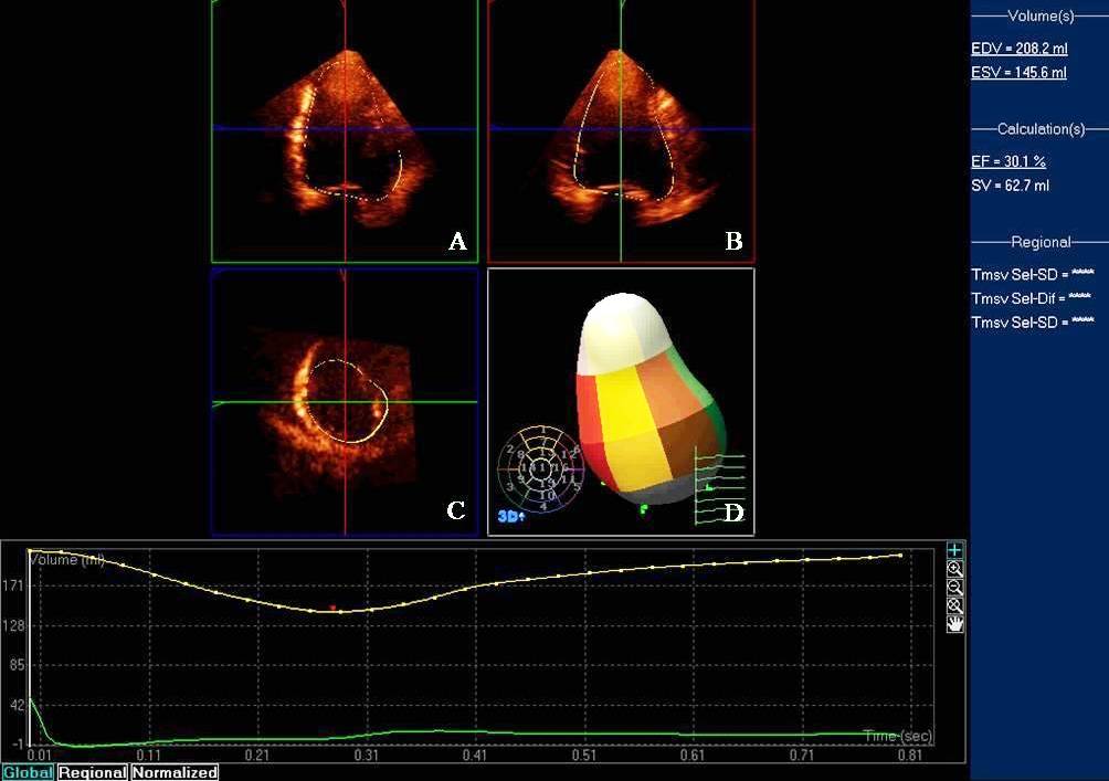 那些年我们错过的歌曲,那些年我们错过的日子